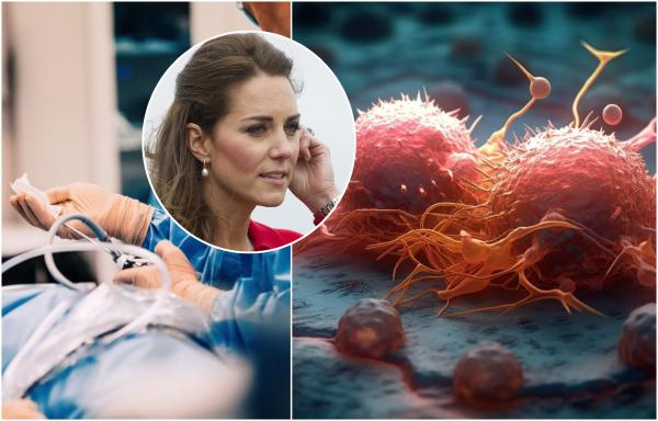 Velso princesei Kate taikoma prevencinė chemoterapija: paaiškino, kas tai